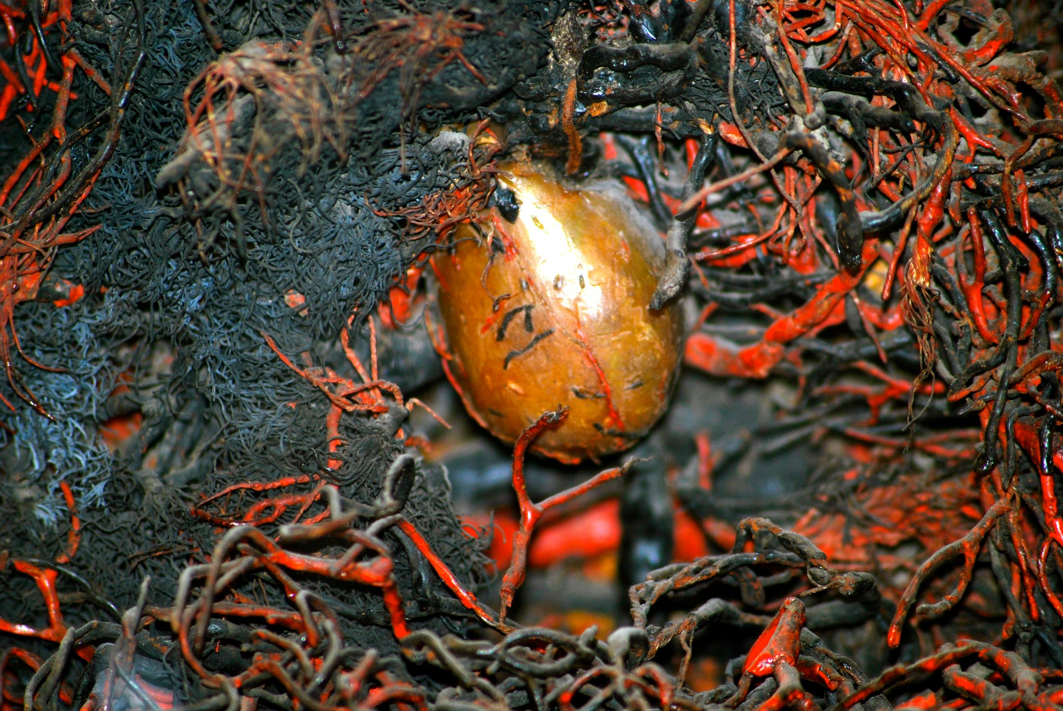 Man's gall-bladder.jpg