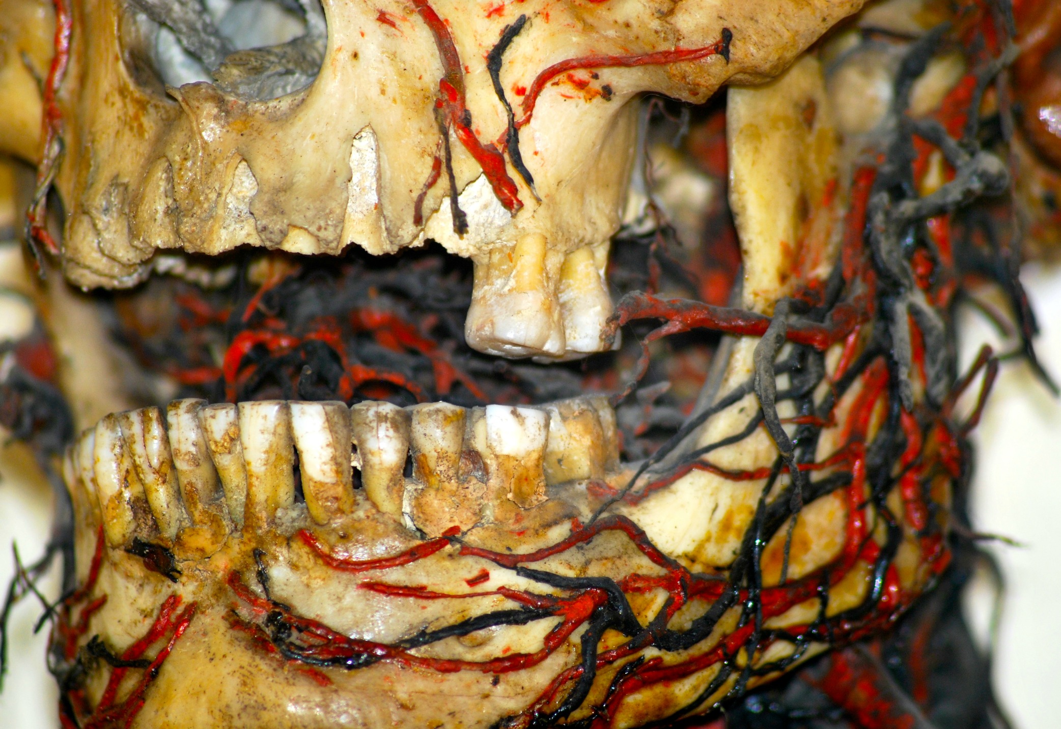 Man's mandible.jpg