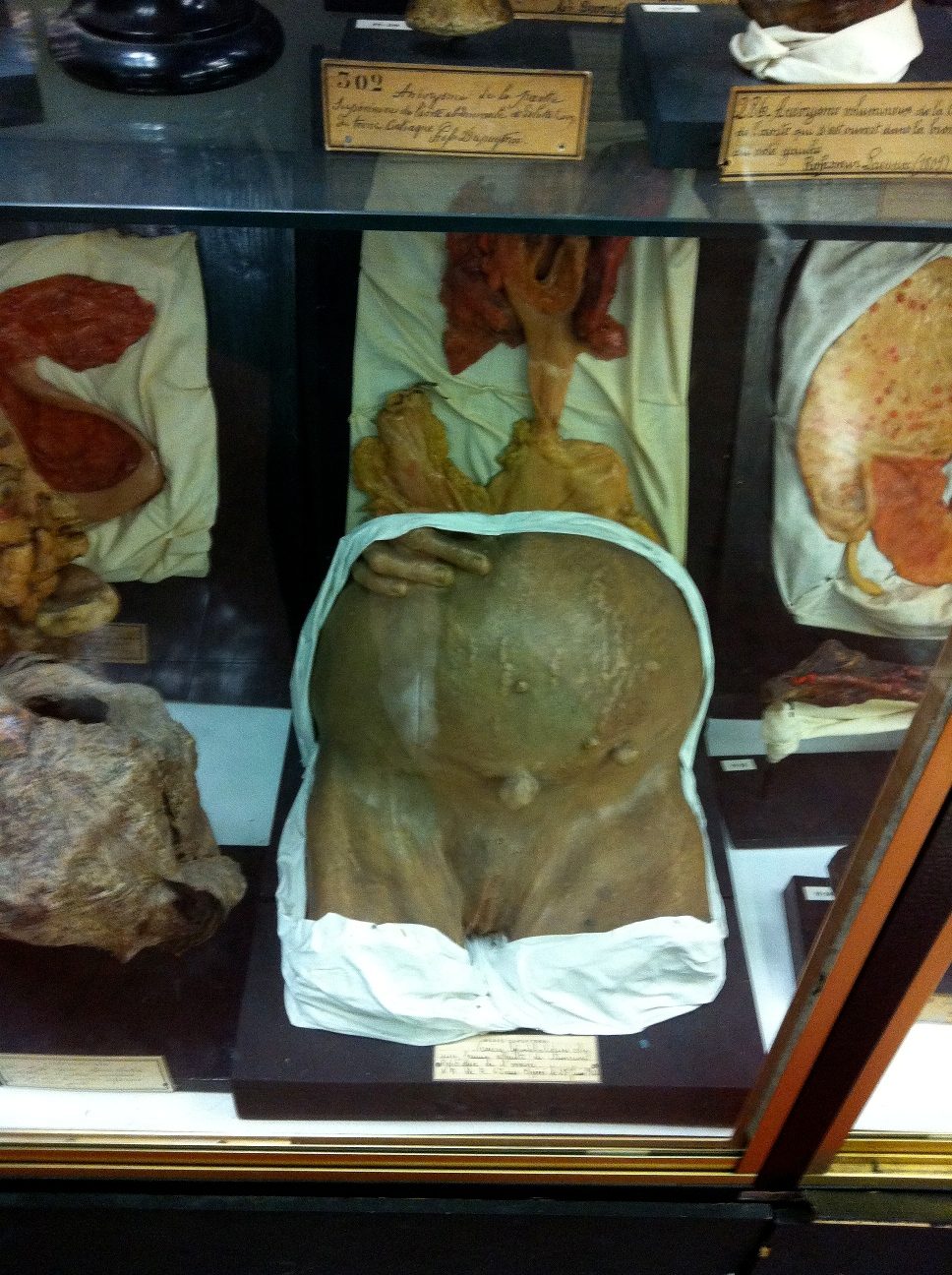 Musee%20Dupuytren%2C%20Paris%20by%20Rosa%20Longo%20-%2006.jpg