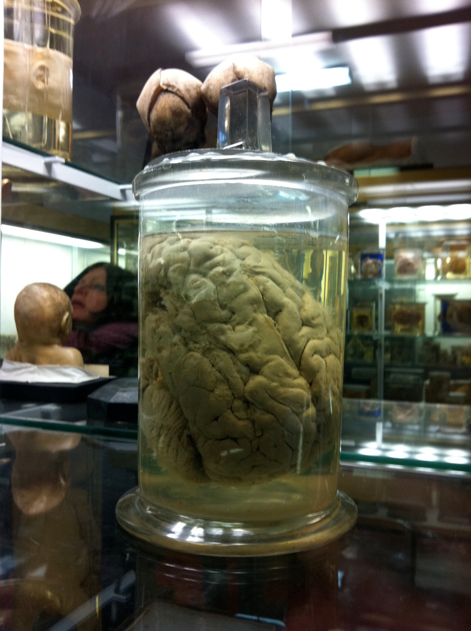 Monsieur Tan's brain, Musee Dupuytren, Paris by Rosa Longo (2).jpg
