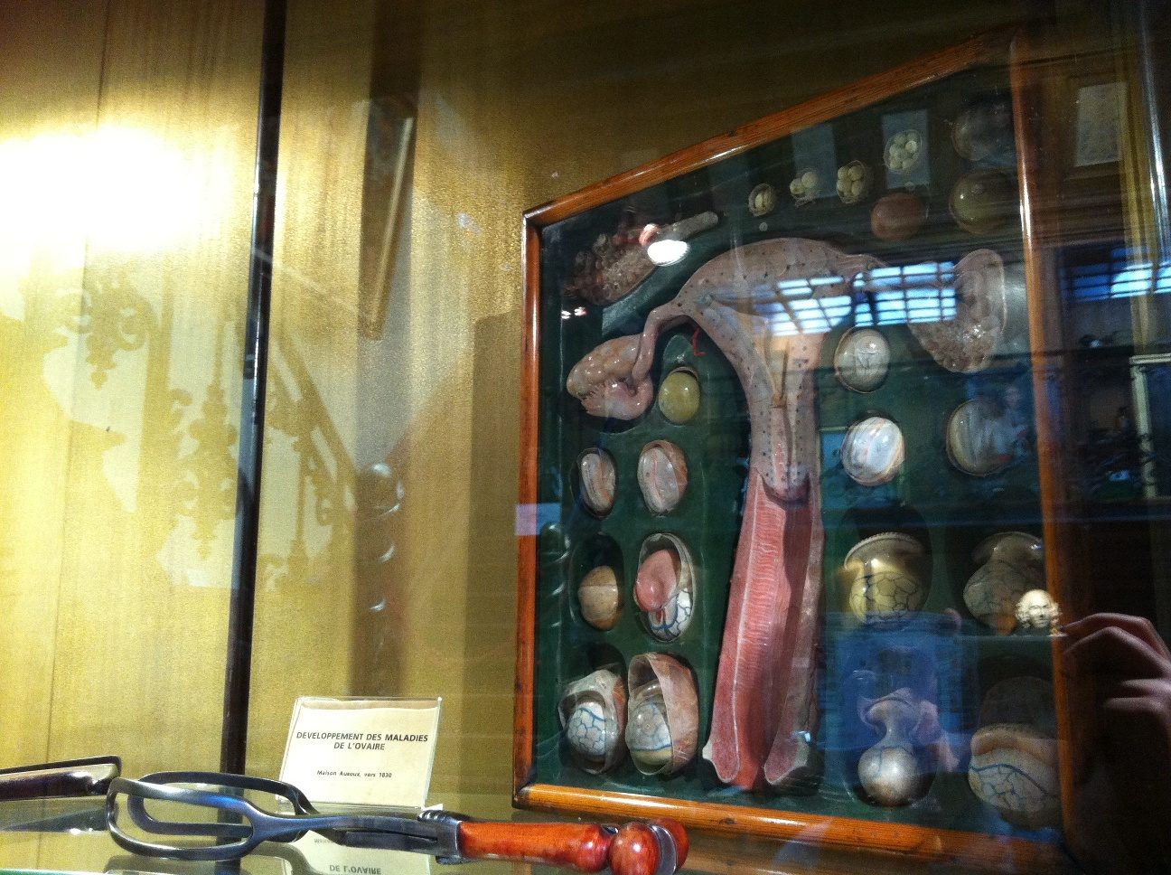Musee d'Histoire de la Medecine, Paris by Rosa Longo - 08.JPG